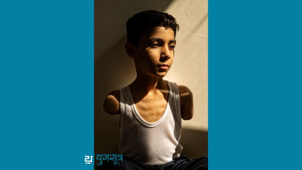 २०२५ को वर्ल्ड प्रेस फोटो अफ द इयर पुरस्कार सामर अबु एलौफलाई, गाजा आक्रमणमा घाइते बालकको मार्मिक तस्बिर सम्मानित